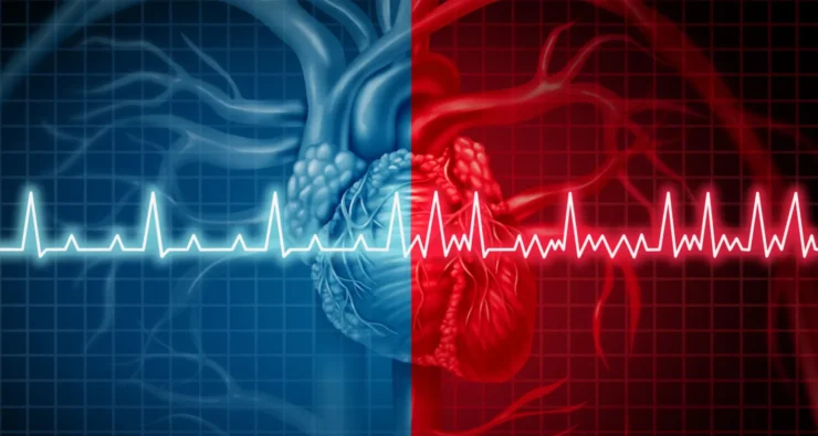 AI from Google recognizes risk of heart attack online